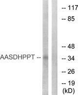 AASDHPPT / LYS5 Antibody - Western blot analysis of extracts from COLO cells, using AASDHPPT antibody.