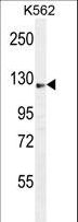 AASS / LKR / SDH Antibody - AASS Antibody western blot of K562 cell line lysates (35 ug/lane). The AASS antibody detected the AASS protein (arrow).