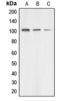 AASS / LKR / SDH Antibody - Western blot analysis of AASS expression in HUVEC (A); HeLa (B); HEK293T (C) whole cell lysates.