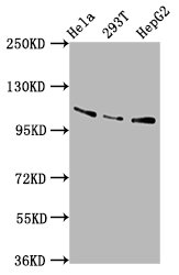 AASS / LKR / SDH Antibody - Western Blot Positive WB detected in: Hela whole cell lysate, 293T whole cell lysate, HepG2 whole cell lysate All Lanes: AASS antibody at 5.8µg/ml Secondary Goat polyclonal to rabbit IgG at 1/50000 dilution Predicted band size: 103 KDa Observed band size: 103 KDa