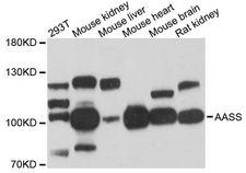 AASS / LKR / SDH Antibody - Western blot analysis of extracts of various cell lines, using AASS antibody at 1:3000 dilution. The secondary antibody used was an HRP Goat Anti-Rabbit IgG (H+L) at 1:10000 dilution. Lysates were loaded 25ug per lane and 3% nonfat dry milk in TBST was used for blocking. An ECL Kit was used for detection and the exposure time was 30s.
