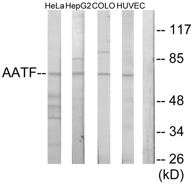 AATF Antibody - Western blot analysis of lysates from HeLa cells, HepG2 cells, COLO205 cells, and HUVEC cells, using AATF Antibody. The lane on the right is blocked with the synthesized peptide.