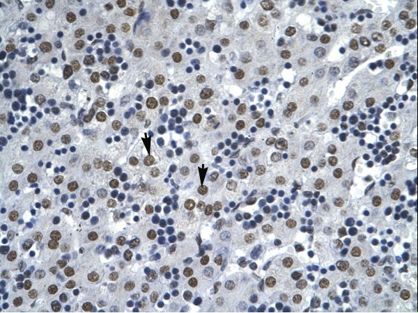 AATF Antibody - AATF antibody ARP31867_P050-NP_036270-AATF (apoptosis antagonizing transcription factor) Antibody was used in IHC to stain formalin-fixed, paraffin-embedded human liver.  This image was taken for the unconjugated form of this product. Other forms have not been tested.