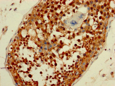 AATF Antibody - IHC image of AATF Antibody diluted at 1:200 and staining in paraffin-embedded human testis tissue performed on a Leica BondTM system. After dewaxing and hydration, antigen retrieval was mediated by high pressure in a citrate buffer (pH 6.0). Section was blocked with 10% normal goat serum 30min at RT. Then primary antibody (1% BSA) was incubated at 4°C overnight. The primary is detected by a biotinylated secondary antibody and visualized using an HRP conjugated SP system.