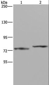 AATF Antibody - Western blot analysis of Mouse heart tissue and 231 cell, using AATF Polyclonal Antibody at dilution of 1:667.