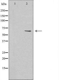 AATF Antibody - Western blot analysis of extracts of HeLa cells using AATF antibody. The lane on the left is treated with the antigen-specific peptide.