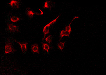 AATF Antibody - Staining HeLa cells by IF/ICC. The samples were fixed with PFA and permeabilized in 0.1% Triton X-100, then blocked in 10% serum for 45 min at 25°C. The primary antibody was diluted at 1:200 and incubated with the sample for 1 hour at 37°C. An Alexa Fluor 594 conjugated goat anti-rabbit IgG (H+L) Ab, diluted at 1/600, was used as the secondary antibody.