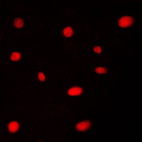 AATF Antibody - Immunofluorescent analysis of AATF staining in HeLa cells. Formalin-fixed cells were permeabilized with 0.1% Triton X-100 in TBS for 5-10 minutes and blocked with 3% BSA-PBS for 30 minutes at room temperature. Cells were probed with the primary antibody in 3% BSA-PBS and incubated overnight at 4 C in a humidified chamber. Cells were washed with PBST and incubated with a DyLight 594-conjugated secondary antibody (red) in PBS at room temperature in the dark. DAPI was used to stain the cell nuclei (blue).