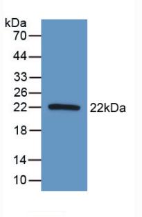 AATK / AATYK Antibody - Western Blot; Sample: Recombinant AATK, Human.