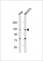 AATK / AATYK Antibody - All lanes : Anti-AATK Antibody at 1:2000 dilution Lane 1: HeLa whole cell lysates Lane 2: NIH/3T3 whole cell lysates Lysates/proteins at 20 ug per lane. Secondary Goat Anti-Rabbit IgG, (H+L), Peroxidase conjugated at 1/10000 dilution Predicted band size : 145 kDa Blocking/Dilution buffer: 5% NFDM/TBST.