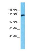 AATK / AATYK Antibody - Western blot of AATK Antibody with 293T Whole cell lysate.  This image was taken for the unconjugated form of this product. Other forms have not been tested.