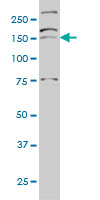 AATK / AATYK Antibody - AATK monoclonal antibody (M03), clone 5B8 Western blot of AATK expression in HeLa NE.