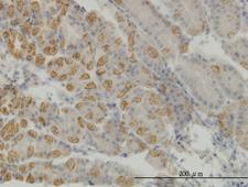 AATK / AATYK Antibody - Immunoperoxidase of monoclonal antibody to AATK on formalin-fixed paraffin-embedded human stomach. [antibody concentration 1 ug/ml]
