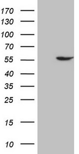 ABAT Antibody - HEK293T cells were transfected with the pCMV6-ENTRY control. (Left lane) or pCMV6-ENTRY ABAT. (Right lane) cDNA for 48 hrs and lysed. Equivalent amounts of cell lysates. (5 ug per lane) were separated by SDS-PAGE and immunoblotted with anti-ABAT.