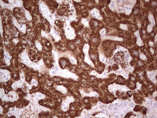 ABAT Antibody - Immunohistochemical staining of paraffin-embedded Human liver tissue within the normal limits using anti-ABAT mouse monoclonal antibody. (Heat-induced epitope retrieval by 1 mM EDTA in 10mM Tris, pH8.5, 120C for 3min,