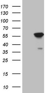 ABAT Antibody - HEK293T cells were transfected with the pCMV6-ENTRY control. (Left lane) or pCMV6-ENTRY ABAT. (Right lane) cDNA for 48 hrs and lysed. Equivalent amounts of cell lysates. (5 ug per lane) were separated by SDS-PAGE and immunoblotted with anti-ABAT.