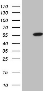 ABAT Antibody - HEK293T cells were transfected with the pCMV6-ENTRY control (Left lane) or pCMV6-ENTRY ABAT (Right lane) cDNA for 48 hrs and lysed. Equivalent amounts of cell lysates (5 ug per lane) were separated by SDS-PAGE and immunoblotted with anti-ABAT.