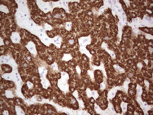 ABAT Antibody - Immunohistochemical staining of paraffin-embedded Human liver tissue within the normal limits using anti-ABAT mouse monoclonal antibody. (Heat-induced epitope retrieval by 1 mM EDTA in 10mM Tris, pH8.5, 120C for 3min,