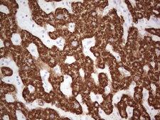 ABAT Antibody - IHC of paraffin-embedded Human liver tissue using anti-ABAT mouse monoclonal antibody. (Heat-induced epitope retrieval by 1 mM EDTA in 10mM Tris, pH8.5, 120°C for 3min).