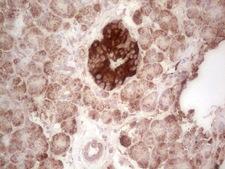 ABAT Antibody - Immunohistochemical staining of paraffin-embedded Human pancreas tissue within the normal limits using anti-ABAT mouse monoclonal antibody. (Heat-induced epitope retrieval by 1 mM EDTA in 10mM Tris, pH8.5, 120C for 3min,