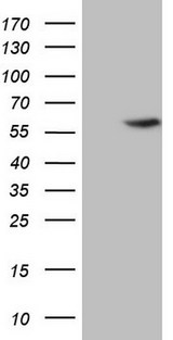 ABAT Antibody - HEK293T cells were transfected with the pCMV6-ENTRY control (Left lane) or pCMV6-ENTRY ABAT (Right lane) cDNA for 48 hrs and lysed. Equivalent amounts of cell lysates (5 ug per lane) were separated by SDS-PAGE and immunoblotted with anti-ABAT.