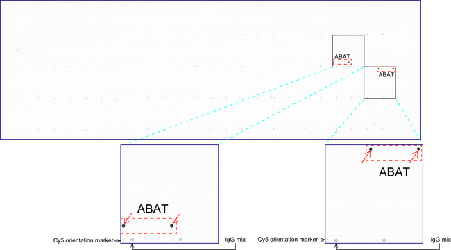 ABAT Antibody - OriGene overexpression protein microarray chip was immunostained with UltraMAB anti-ABAT mouse monoclonal antibody. The positive reactive proteins are highlighted with two red arrows in the enlarged subarray. All the positive controls spotted in this subarray are also labeled for clarification. (1:100)