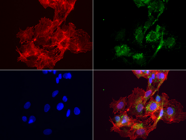 ABAT Antibody - Immunofluorescent staining of HepG2 cells using anti-ABAT mouse monoclonal antibody  green, 1:50). Actin filaments were labeled with Alexa Fluor® 594 Phalloidin. (red), and nuclear with DAPI. (blue).