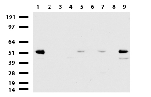 ABAT Antibody - Western blot of cell lysates. (35ug) from 9 different cell lines. (1: HepG2, 2: HeLa, 3: SV-T2, 4: A549. 5: COS7, 6: Jurkat, 7: MDCK, 8: PC-12, 9: MCF7).