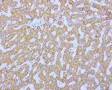 ABAT Antibody - Immunohistochemical staining of paraffin-embedded human liver using ABAT clone UMAB178, mouse monoclonal antibody at 1:200 dilution of 1mg/mL using Polink2 Broad HRP DAB for detection.requires heat-induced epitope retrieval with citrate pH6.0 at 110C for 3 min using pressure chamber/cooker. The image shows strong cytoplasmic and membranous staining of the hepatocytes no staining in the bile duct.