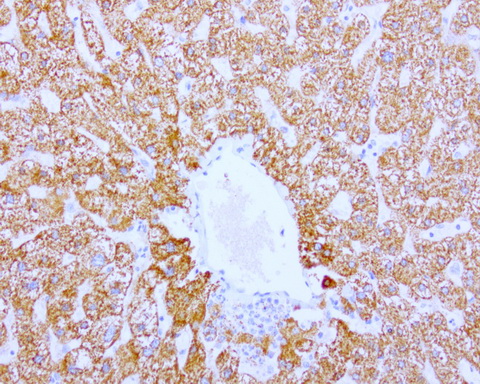ABAT Antibody - Immunohistochemical staining of paraffin-embedded human liver using ABAT clone UMAB179, mouse monoclonal antibody at 1:400 dilution of 1mg/mL using Polink2 Broad HRP DAB for detection.requires heat-induced epitope retrieval with citrate pH6.0 at 110C for 3 min using pressure chamber/cooker. The image shows strong cytoplasmic and membranous staining of the hepatocytes no staining in the bile duct.