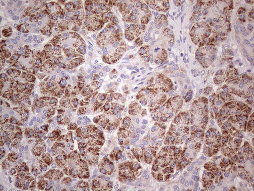 ABAT Antibody - Immunohistochemical staining of paraffin-embedded human pancreas tissue using anti-ABAT mouse monoclonal antibody. Heat-induced epitope retrieval by 1mM EDTA in 10mM Tris buffer. (pH8.0) in pressure chamber/cooker at 110C for 3 min,. Images shows exocrine granular cells with strong granular cytoplasmic staining.