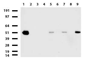 ABAT Antibody - Western blot of cell lysates. (35ug) from 9 different cell lines. (1: HepG2, 2: HeLa, 3: SV-T2, 4: A549. 5: COS7, 6: Jurkat, 7: MDCK, 8: PC-12, 9: MCF7).