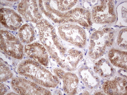 ABAT Antibody - Immunohistochemical staining of paraffin-embedded human kidney tissue using anti-ABAT mouse monoclonal antibody. Heat-induced epitope retrieval by 1mM EDTA in 10mM Tris buffer. (pH8.0) in pressure chamber/cooker at 110C for 3 min,1:400 shows kidney tubules with strong granular cytoplasmic staining.