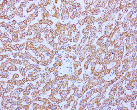 ABAT Antibody - Immunohistochemical staining of paraffin-embedded human liver using ABAT clone UMAB180, mouse monoclonal antibody at 1:1500 dilution of 1mg/mL using Polink2 Broad HRP DAB for detection.requires heat-induced epitope retrieval with citrate pH6.0 at 110C for 3 min using pressure chamber/cooker. The image shows strong cytoplasmic and membranous staining of the hepatocytes no staining in the bile duct.