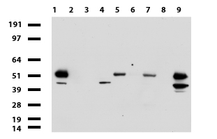 ABAT Antibody - Western blot of cell lysates. (35ug) from 9 different cell lines. (1: HepG2, 2: HeLa, 3: SV-T2, 4: A549, 5: COS7, 6: Jurkat, 7: MDCK, 8: PC-12, 9: MCF7). Diluation: 1:500