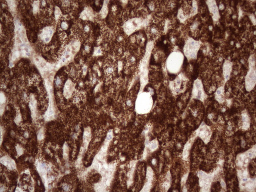 ABAT Antibody - Immunohistochemical staining of paraffin-embedded human liver tissue using ABAT clone UMAB180, mouse monoclonal antibody. Using heat-induced epitope retrieval with 1mM EDTA in 10mM Tris buffer. (pH8.0) at 110°C for 3 min prior in pressure chamber/cooker todiluted 1:1000 application. Detection with HRP enzyme and DAB chromogen was use to visualize result. Strong cytoplasmic and membranous staining is seen in the hepatocytes. Staining was not observed in the bile ducts of the liver.