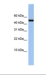 ABAT Antibody - Placenta lysate. Antibody concentration: 1.0 ug/ml. Gel concentration: 10-20%.  This image was taken for the unconjugated form of this product. Other forms have not been tested.