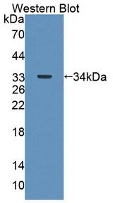 ABAT Antibody - Western Blot; Sample: Recombinant protein.