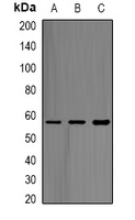 ABAT Antibody - Western blot analysis of ABAT expression in SW480 (A); mouse kidney (B); mouse brain (C) whole cell lysates.
