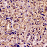ABAT Antibody - Immunohistochemical analysis of ABAT staining in rat kidney formalin fixed paraffin embedded tissue section. The section was pre-treated using heat mediated antigen retrieval with sodium citrate buffer (pH 6.0). The section was then incubated with the antibody at room temperature and detected using an HRP conjugated compact polymer system. DAB was used as the chromogen. The section was then counterstained with hematoxylin and mounted with DPX.