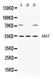ABAT Antibody - Western blot - Anti-ABAT Picoband Antibody