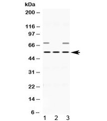 ABAT Antibody - Western blot testing of 1) rat brain, 2) mouse testis and 3) HepG2 lysate with ABAT antibody at 0.5ug/ml. Predicted molecular weight ~54 kDa.