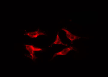 ABAT Antibody - Staining HepG2 cells by IF/ICC. The samples were fixed with PFA and permeabilized in 0.1% Triton X-100, then blocked in 10% serum for 45 min at 25°C. The primary antibody was diluted at 1:200 and incubated with the sample for 1 hour at 37°C. An Alexa Fluor 594 conjugated goat anti-rabbit IgG (H+L) Ab, diluted at 1/600, was used as the secondary antibody.