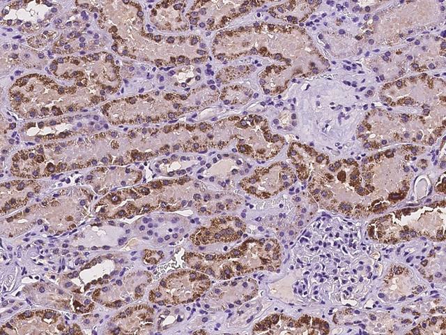 ABAT Antibody - Immunochemical staining of human ABAT in human kidney with rabbit polyclonal antibody at 1:100 dilution, formalin-fixed paraffin embedded sections.