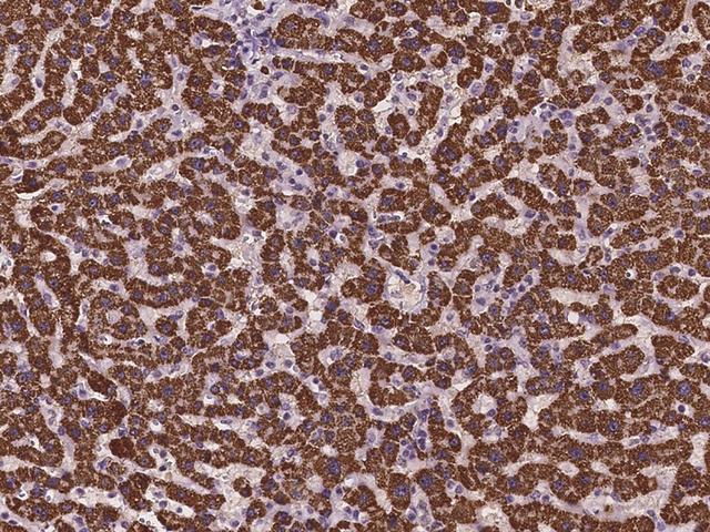 ABAT Antibody - Immunochemical staining of human ABAT in human liver with rabbit polyclonal antibody at 1:100 dilution, formalin-fixed paraffin embedded sections.