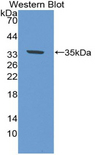 ABCA1 Antibody - Western blot of recombinant ABCA1.