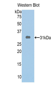 ABCA1 Antibody - Western blot of recombinant ABCA1.  This image was taken for the unconjugated form of this product. Other forms have not been tested.