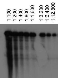 ABCA1 Antibody - Detection of ABCA1 using ABCA1, mouse antibody at various dilutions in ABCA1 transfected HeLa lysates.