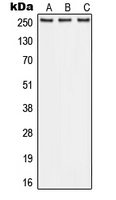 ABCA1 Antibody - Western blot analysis of ABCA1 expression in A549 (A); Raw264.7 (B); PC12 (C) whole cell lysates.