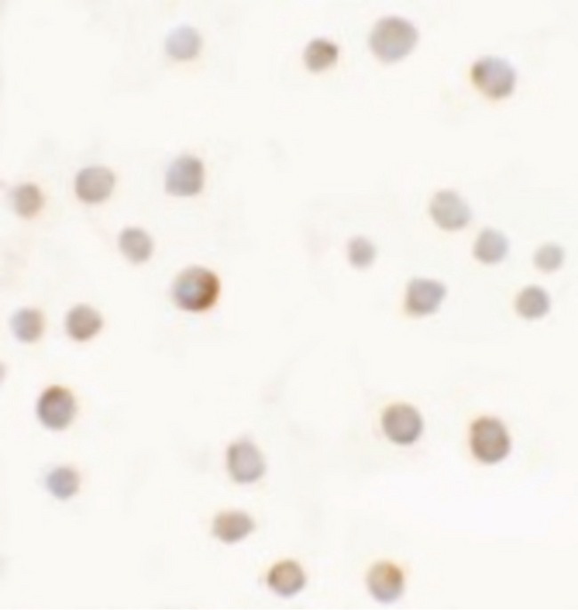 ABCA1 Antibody - Immunocytochemistry of ABCA7 in 293 cells with ABCA7 antibody at 5 ug/ml.